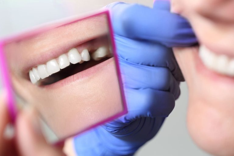 Come si fa un impianto dentale a Firenze
